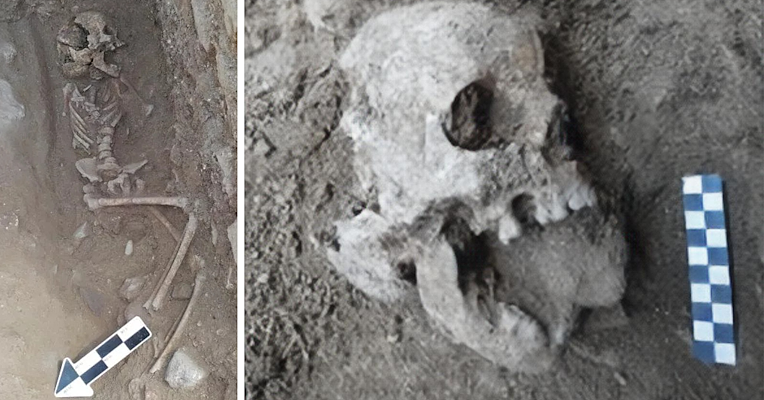 Partially buried human skeleton with a damaged skull in close-up, a stone placed in its mouth, and a measuring scale next to it.